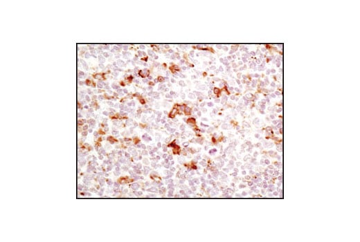 Immunohistochemistry Image 2: PDI (C81H6) Rabbit Monoclonal Antibody (BSA and Azide Free)