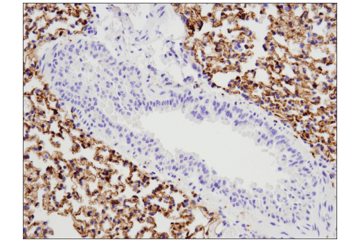 Tau (D1M9X) XP® Rabbit mAb | Cell Signaling Technology