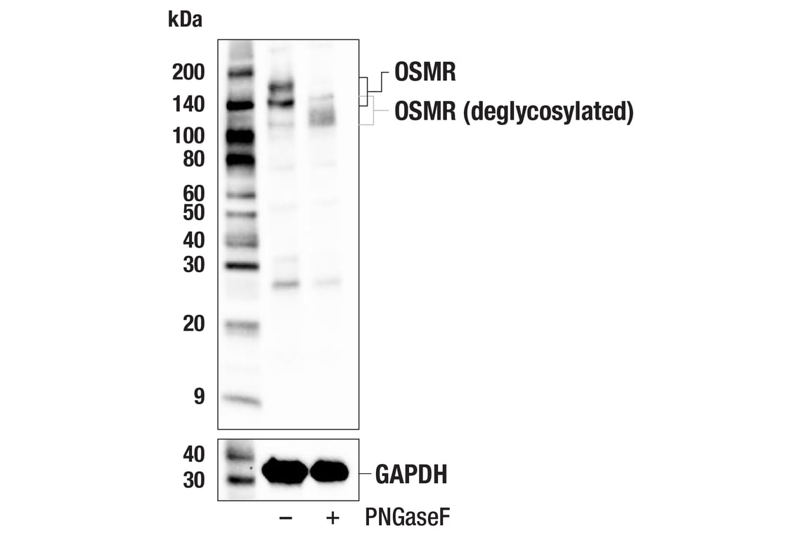 Western Blotting Image 2: OSMR (F9Q2W) Rabbit Monoclonal Antibody