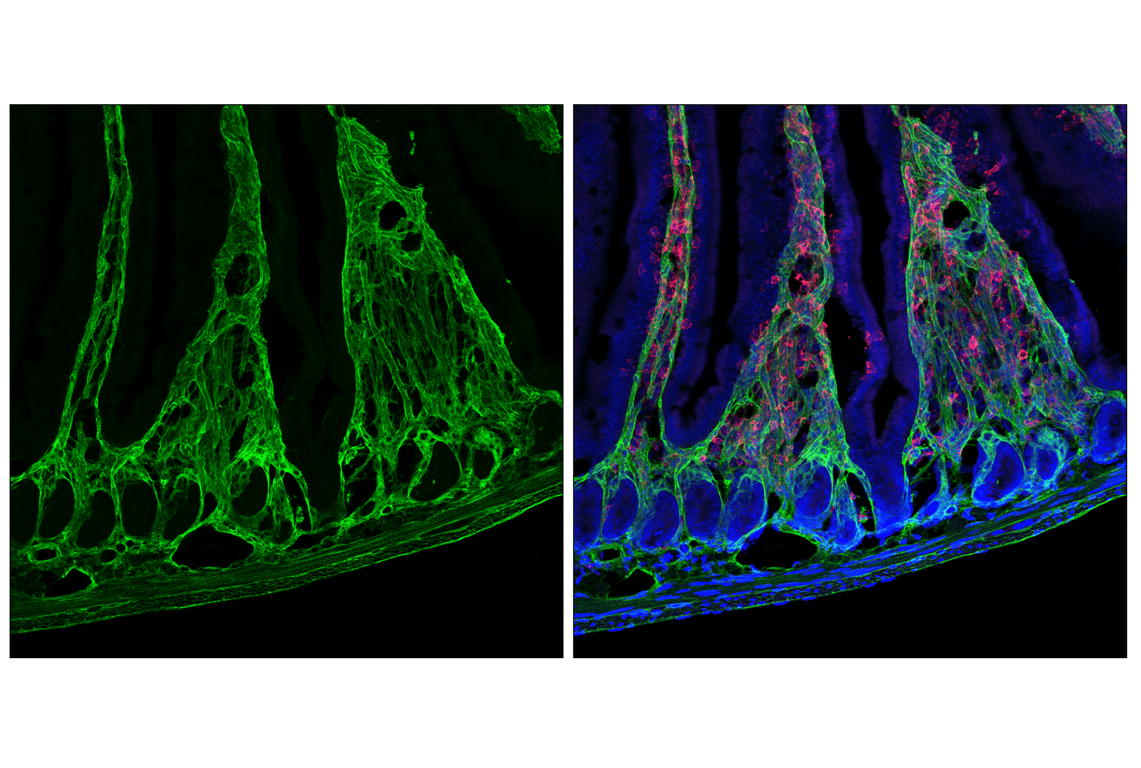 Immunofluorescence Image 3: COL6A1 (E9U3B) Rabbit Monoclonal Antibody