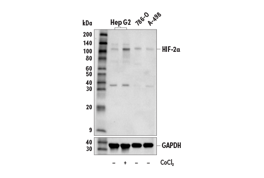 Western Blotting Image 1: HIF-2α (E7K6E) Rabbit mAb