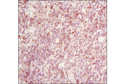 Immunohistochemistry Image 3: RSK2 (D21B2) Rabbit Monoclonal Antibody
