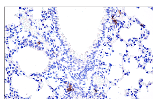 Immunohistochemistry Image 5: GITR (E9O9H) Rabbit Monoclonal Antibody (BSA and Azide Free)