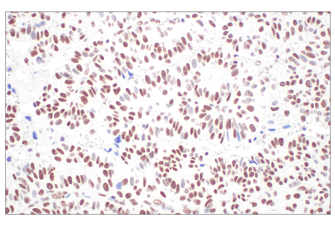 ma様 CBX7 (E7N1W) Rabbit Monoclonal Antibody | Cell Signaling Technology