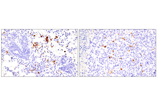 Immunohistochemistry Image 2: ICOS (E5F7E) Rabbit Monoclonal Antibody
