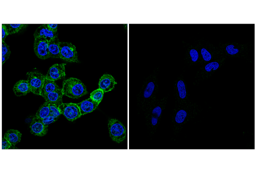 Immunofluorescence Image 1: DAP12 (E7U7T) Rabbit Monoclonal Antibody