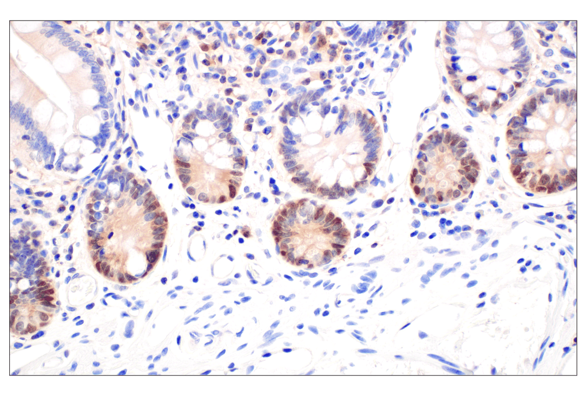 Immunohistochemistry Image 6: CDK6 (E3E3Q) Rabbit Monoclonal Antibody