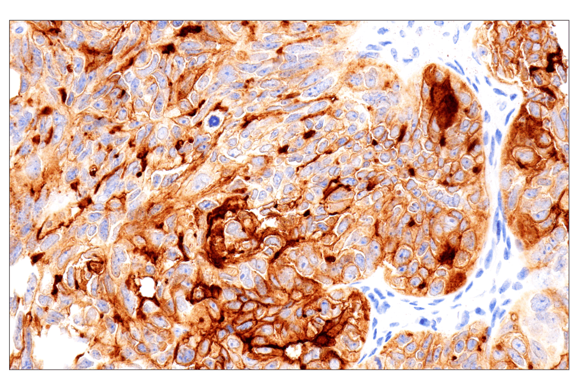 Immunohistochemistry Image 1: Folate Receptor Alpha/FOLR1 (BN3.2) Mouse Monoclonal Antibody