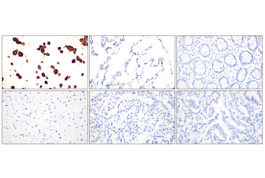 Immunohistochemistry Image 1: SARS-CoV-2 Nucleocapsid Protein (HL344) Rabbit Monoclonal Antibody
