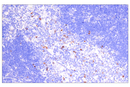 Immunohistochemistry Image 9: CTLA-4 (E2V1Z) Rabbit Monoclonal Antibody (BSA and Azide Free)