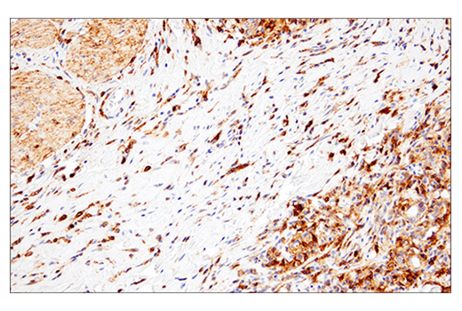 Immunohistochemistry Image 6: CD38 (E7Z8C) Rabbit Monoclonal Antibody