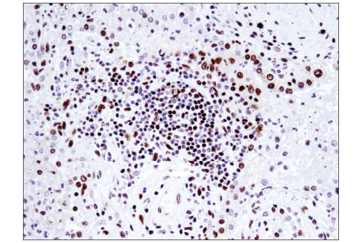 undefined Image 48: BAF Complex IHC Antibody Sampler Kit