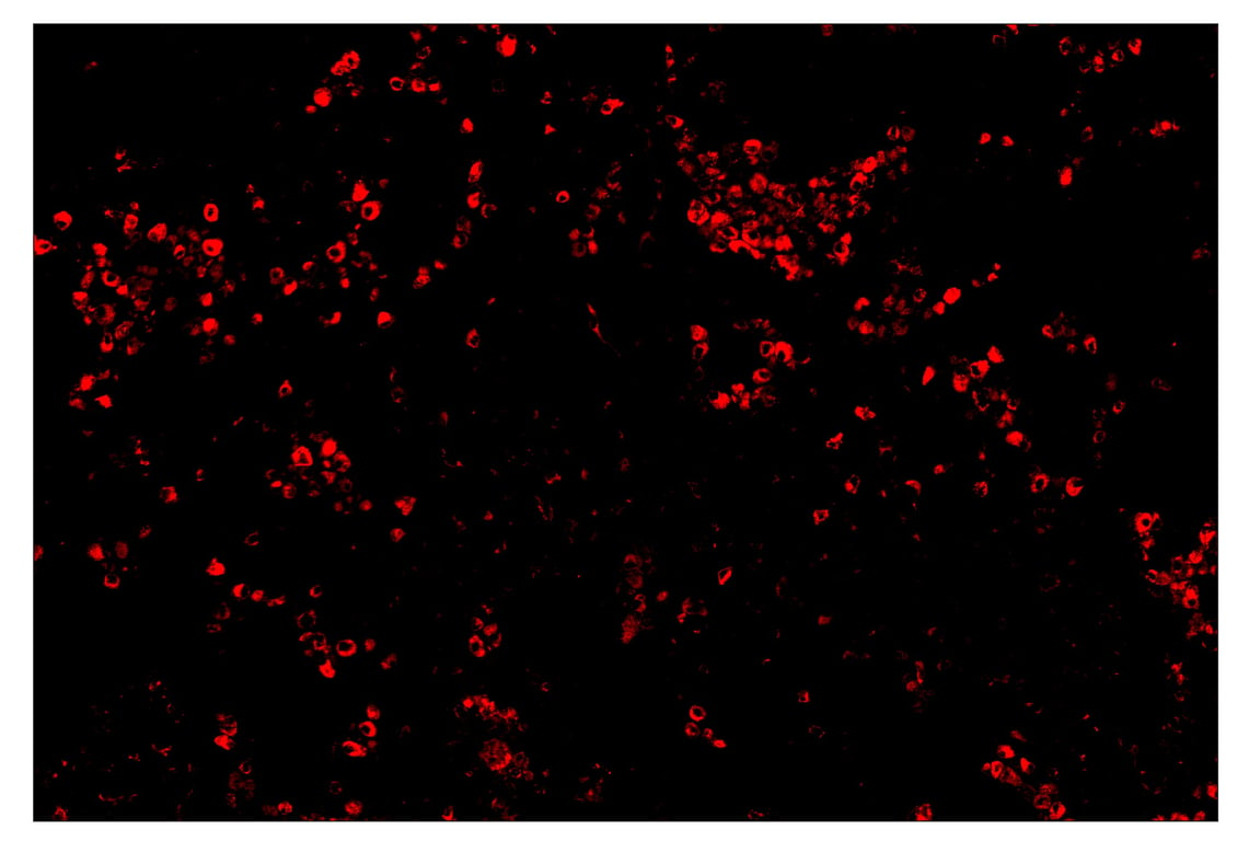 Immunohistochemistry Image 4: CD68 (D4B9C) & CO-0007-647 SignalStar<sup>™</sup> Oligo-Antibody Pair