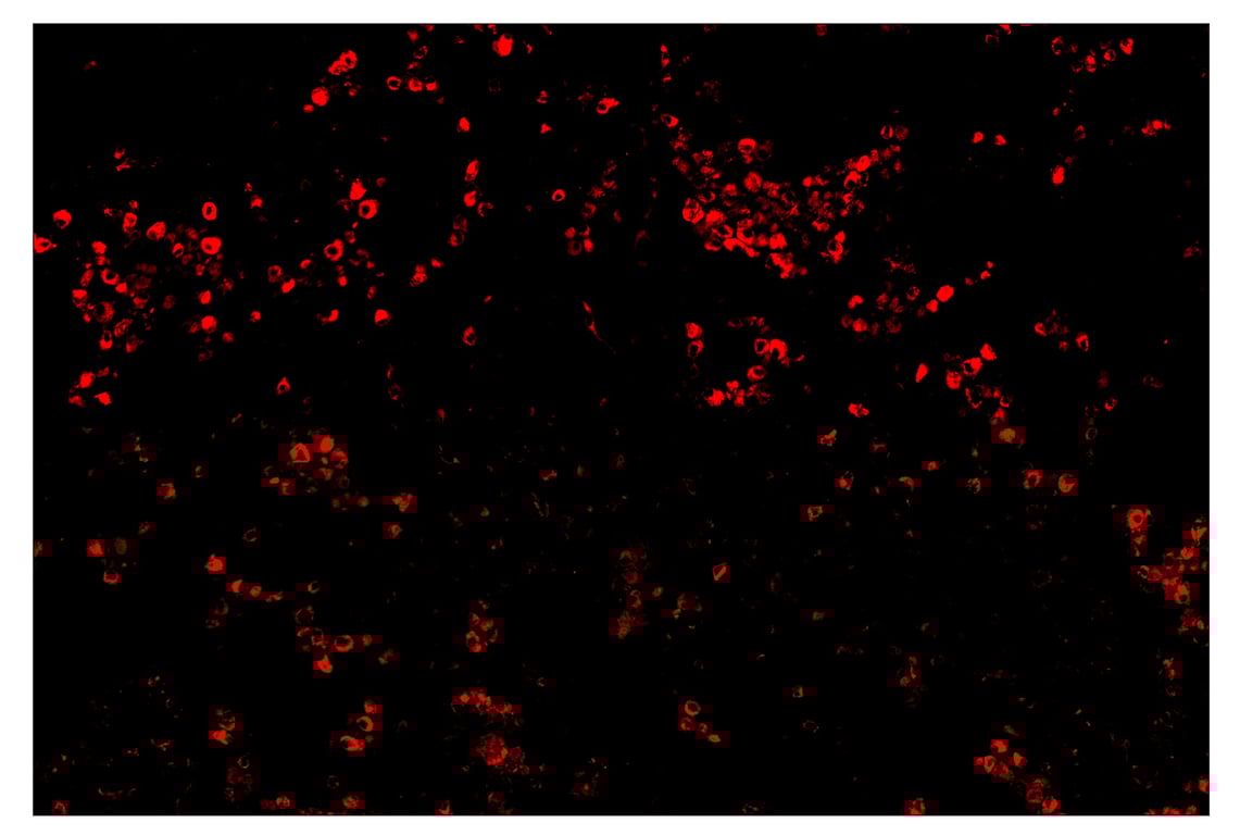 Immunohistochemistry Image 4: CD68 (D4B9C) & CO-0007-750 SignalStar<sup>™</sup> Oligo-Antibody Pair