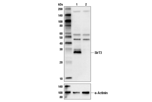 undefined Image 12: Sirtuin Antibody Sampler Kit