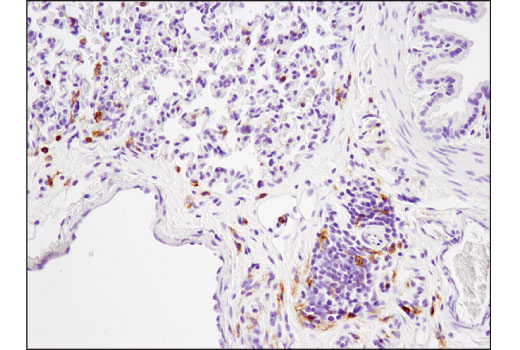 Immunohistochemistry Image 4: CD4 (D7D2Z) Rabbit mAb