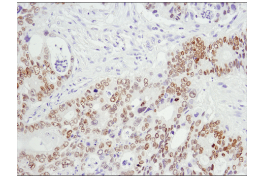 Immunohistochemistry Image 2: HOXB13 (D7N8O) Rabbit Monoclonal Antibody (BSA and Azide Free)