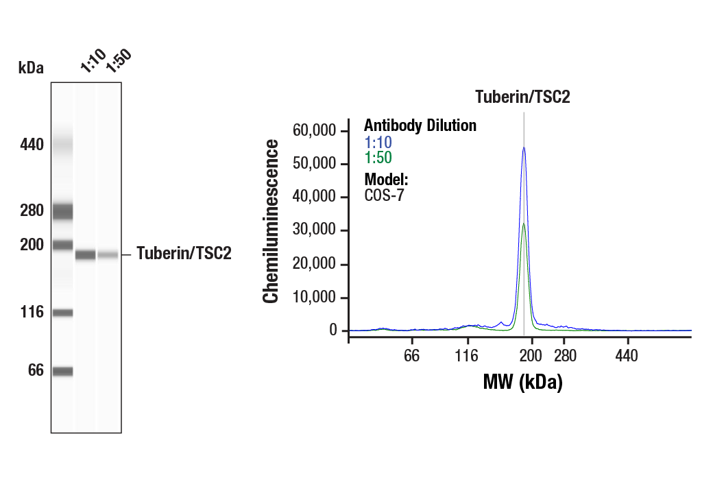 Western Blotting Image 1: Tuberin/TSC2 (D93F12) Rabbit Monoclonal Antibody