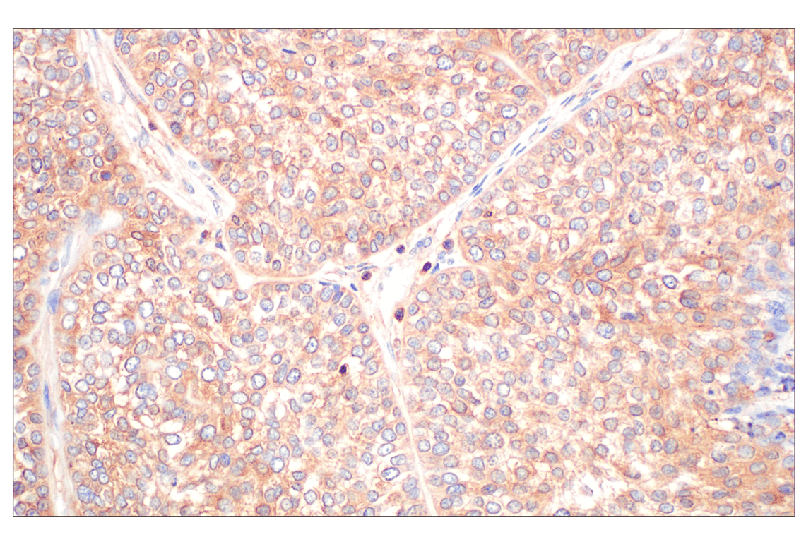 Immunohistochemistry Image 2: WNK1 (F1O3U) Rabbit Monoclonal Antibody