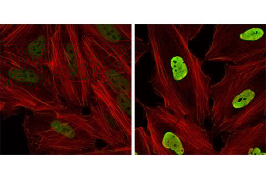 Immunofluorescence Image 1: Acetyl-Histone H3 (Lys9) (C5B11) Rabbit Monoclonal Antibody