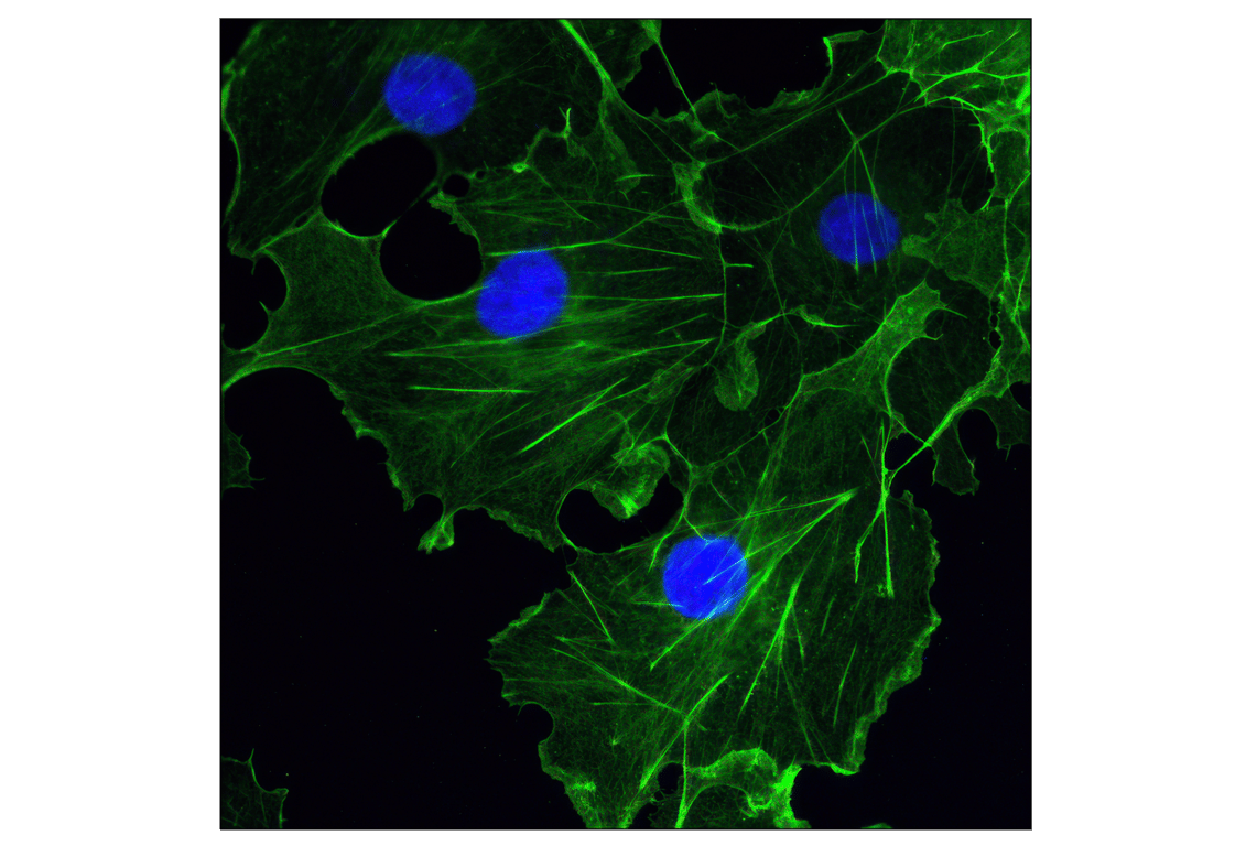 Immunofluorescence Image 1: β-Actin (13E5) Rabbit mAb (Alexa Fluor<sup>®</sup> 488 Conjugate)