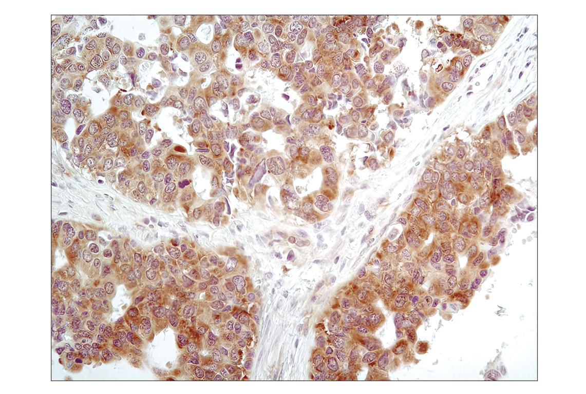Immunohistochemistry Image 2: Phospho-eIF2 alpha (Ser51) (D9G8) Rabbit Monoclonal Antibody (BSA and Azide Free)