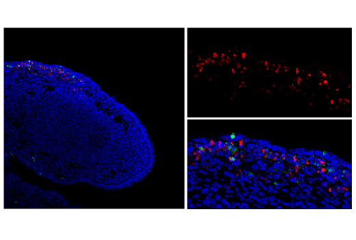 Immunofluorescence Image 1: TUNEL Assay Kit (Fluorescence, 640 nm)