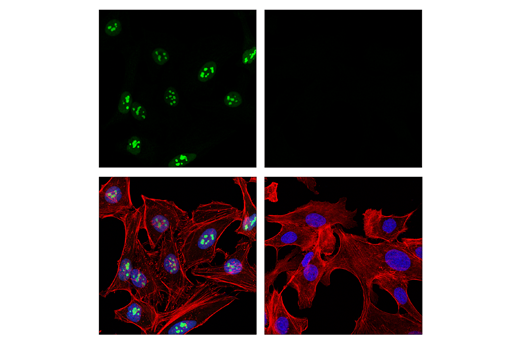 Immunofluorescence Image 1: p14 ARF (E3X6D) Rabbit Monoclonal Antibody (BSA and Azide Free)