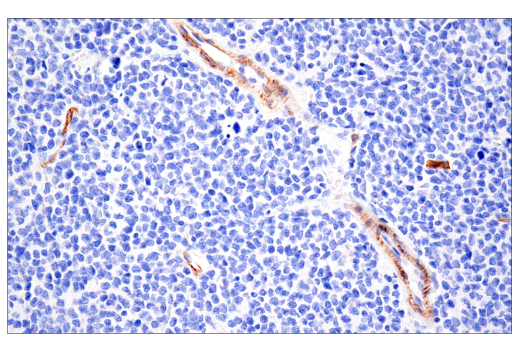Immunohistochemistry Image 5: NG2/CSPG4 (E3B3G) Rabbit Monoclonal Antibody (BSA and Azide Free)