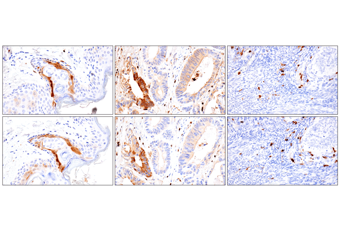 Immunohistochemistry Image 10: S100A8 (F4R2W) Rabbit Monoclonal Antibody
