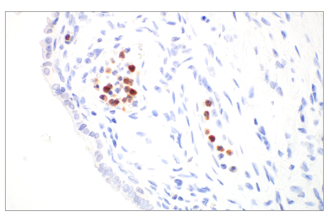Immunohistochemistry Image 5: OLR1/LOX1 (E9C5A) Rabbit Monoclonal Antibody (BSA and Azide Free)