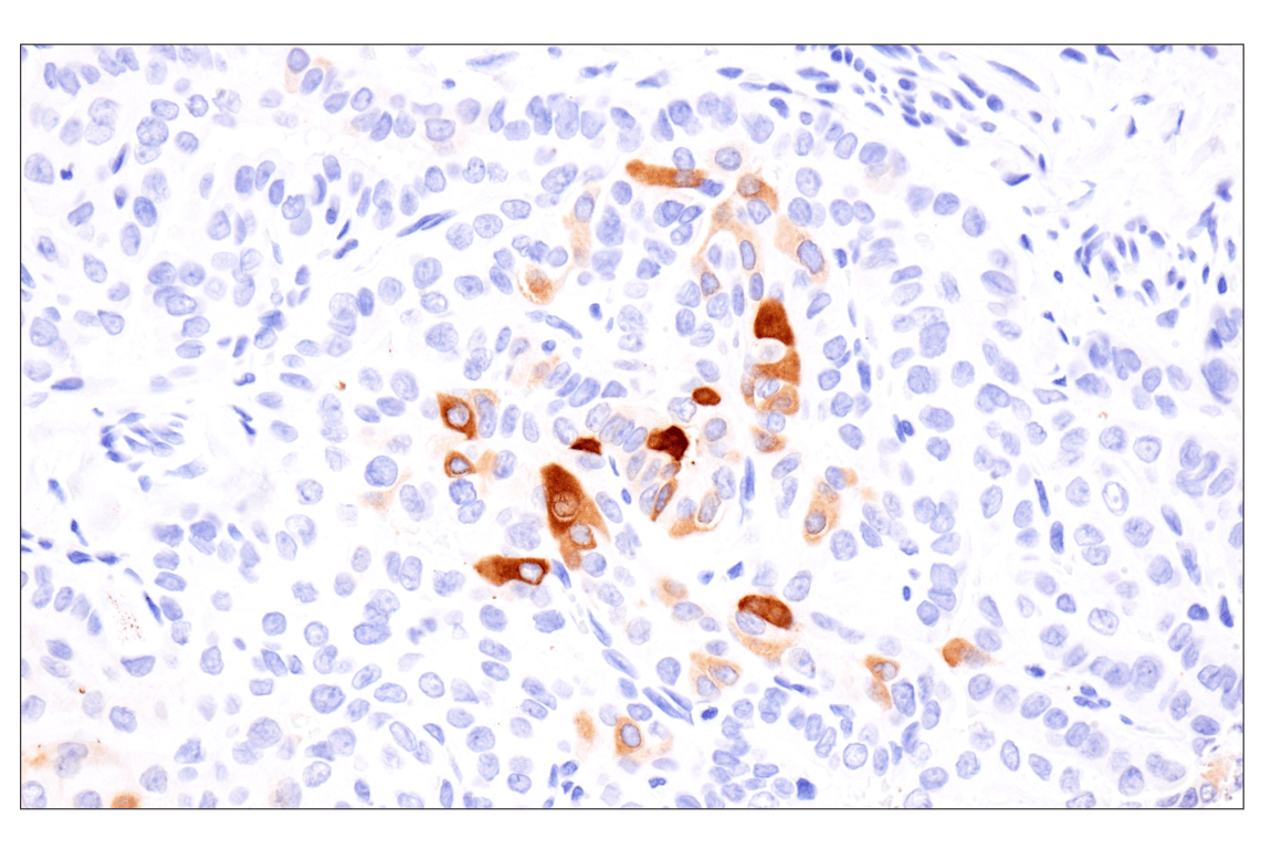 Immunohistochemistry Image 1: Involucrin (F9C3C) Rabbit Monoclonal Antibody