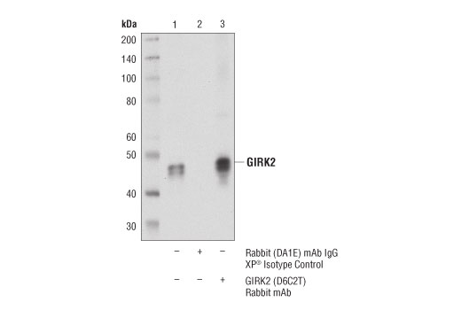 Immunoprecipitation Image 1: GIRK2 (D6C2T) Rabbit Monoclonal Antibody
