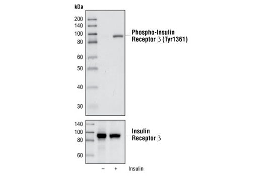 Western Blotting Image 2: Phospho-Insulin Receptor beta (Tyr1361) (84B2) Rabbit Monoclonal Antibody