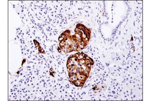 Immunohistochemistry Image 2: PC2 (D1E1S) Rabbit Monoclonal Antibody