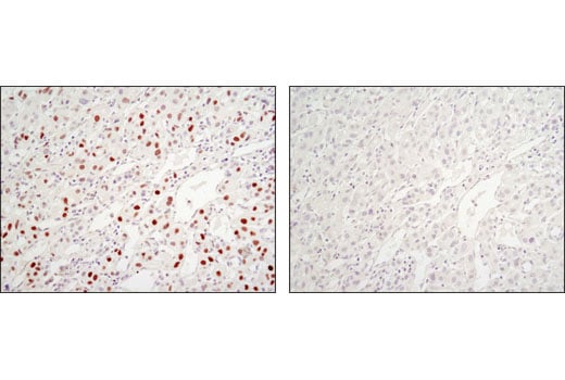 undefined Image 14: C/EBP Antibody Sampler Kit