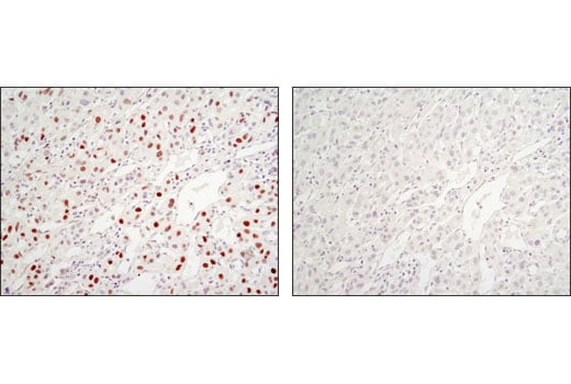 Immunohistochemistry Image 3: C/EBPα (D56F10) XP<sup>®</sup> Rabbit mAb