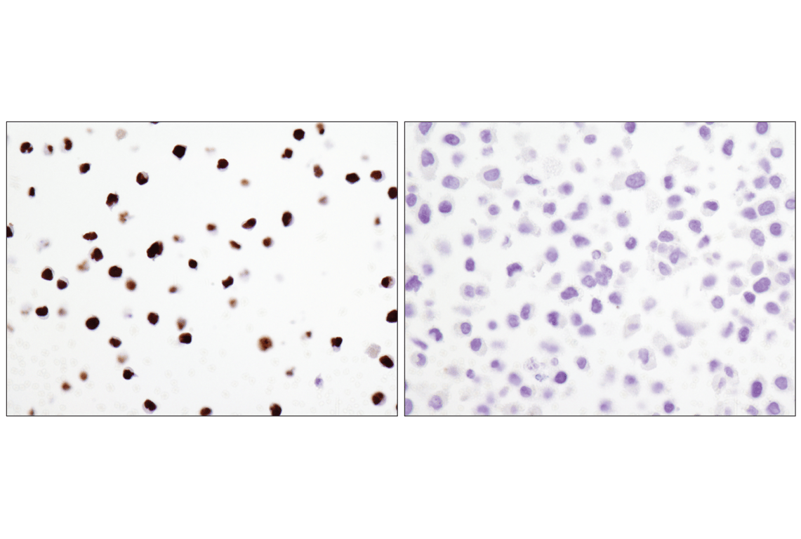 Immunohistochemistry Image 5: PAX5 (D7H5X) Rabbit Monoclonal Antibody