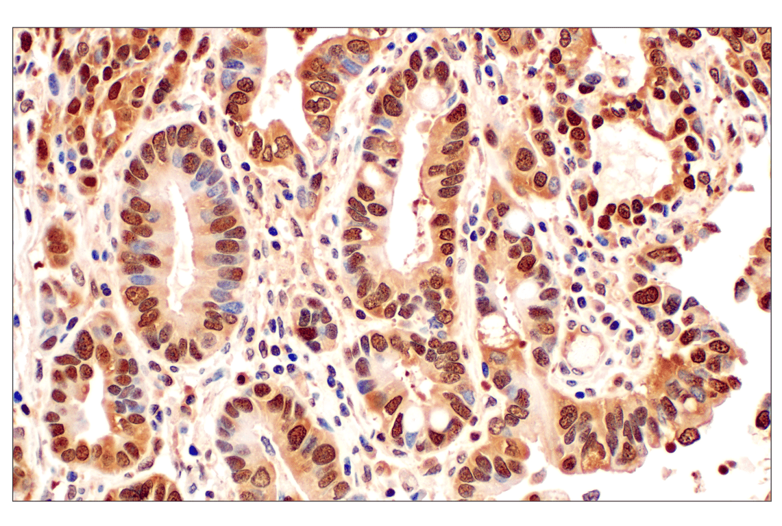Immunohistochemistry Image 1: MTAP (E5R1I) Rabbit Monoclonal Antibody (BSA and Azide Free)