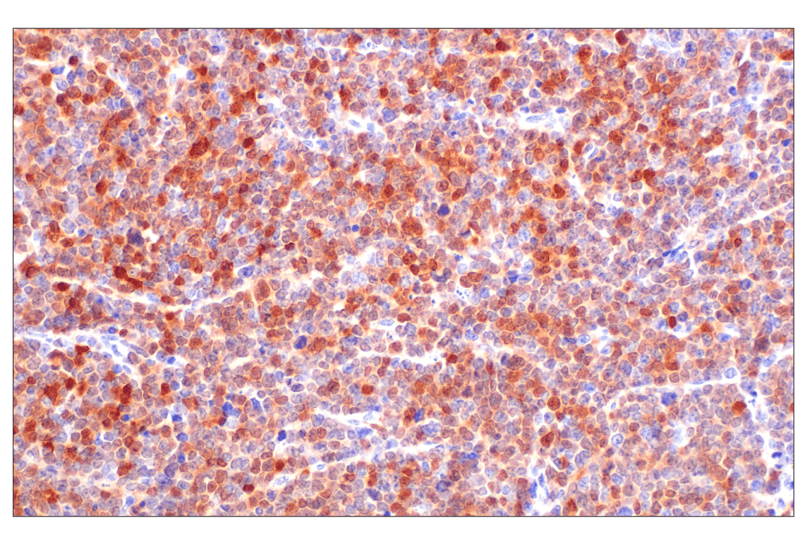 Immunohistochemistry Image 2: p16 INK4A (F2T7H) Rabbit Monoclonal Antibody