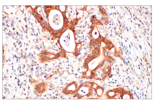 Immunohistochemistry Image 2: Ras (E8N8L) Rabbit Monoclonal Antibody (BSA and Azide Free)