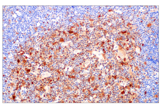 Immunohistochemistry Image 7: SERPINB9 (E9J8J) Rabbit Monoclonal Antibody