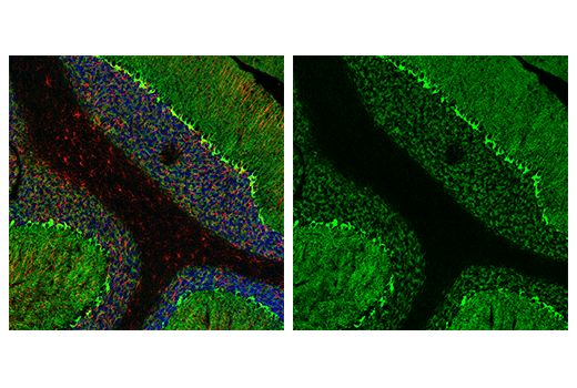 Immunofluorescence Image 1: GAT1 (E7J1B) Rabbit Monoclonal Antibody