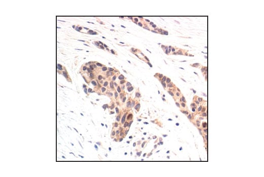 Immunohistochemistry Image 2: Phospho-MEK1/2 (Ser221) (166F8) Rabbit Monoclonal Antibody