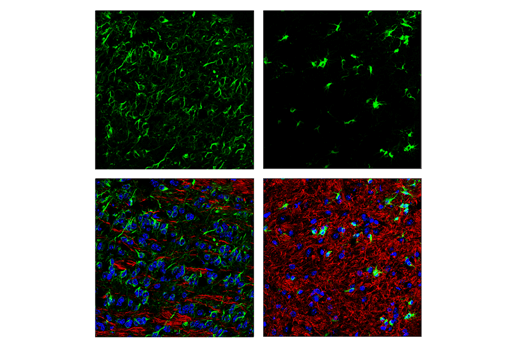 Immunofluorescence Image 1: MAP7 Antibody