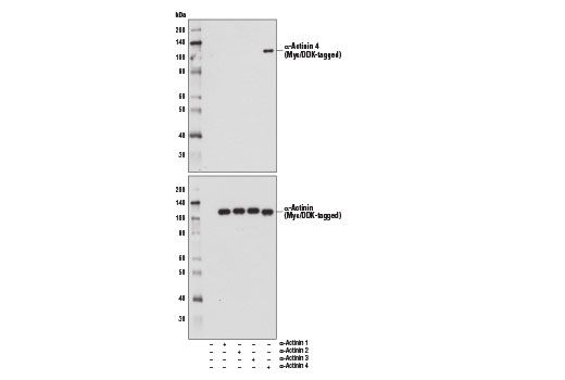 Western Blotting Image 2: alpha-Actinin 4 (D7U5A) Rabbit Monoclonal Antibody 
