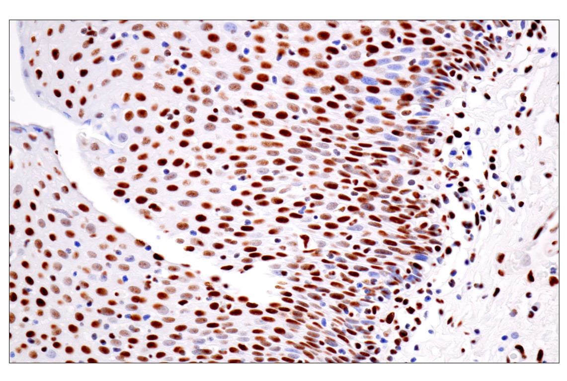 Immunohistochemistry Image 8: ILF3 (E5H6F) Rabbit Monoclonal Antibody