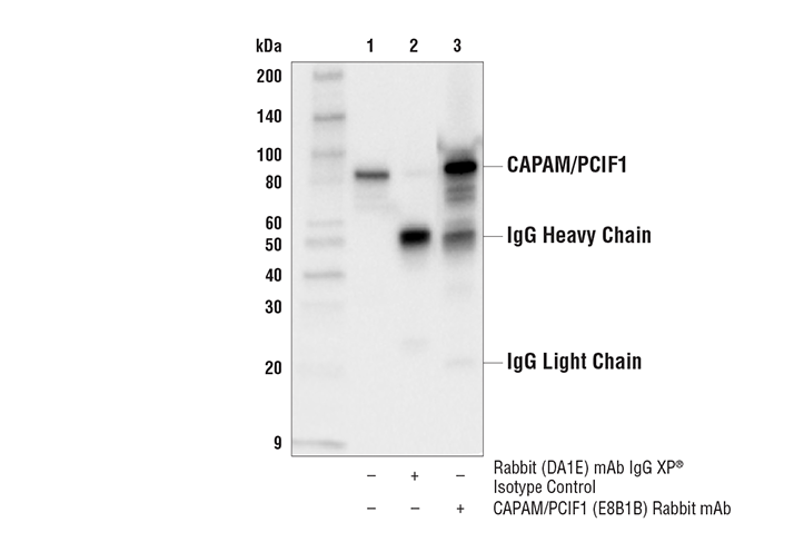 Immunoprecipitation Image 1: CAPAM/PCIF1 (E8B1B) Rabbit Monoclonal Antibody