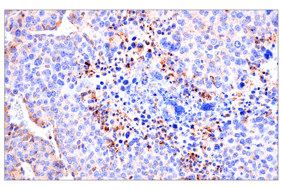 Immunohistochemistry Image 2: HEXB (E9X5S) Rabbit Monoclonal Antibody (BSA and Azide Free)
