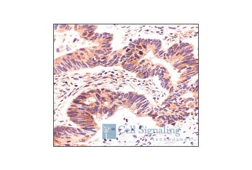 Immunohistochemistry Image 2: S6 Ribosomal Protein (5G10) Rabbit Monoclonal Antibody